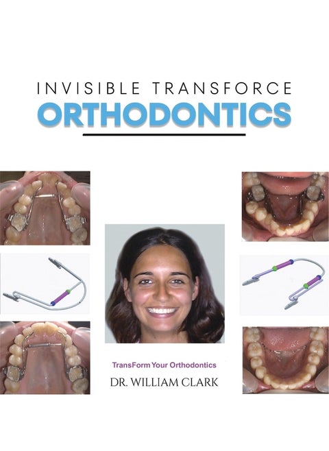 Invisible TransForce Orthodontics
