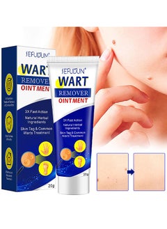 Sefudun Wart Remover Ointment, Smoothes Skin Gentle Fast Acting Gel Wart Removal For Plantar Wart Flat Warts And Corns, Fast-Acting Corn Removal Mask For Plantar, Common And Flat Wart 20G  - Image 1