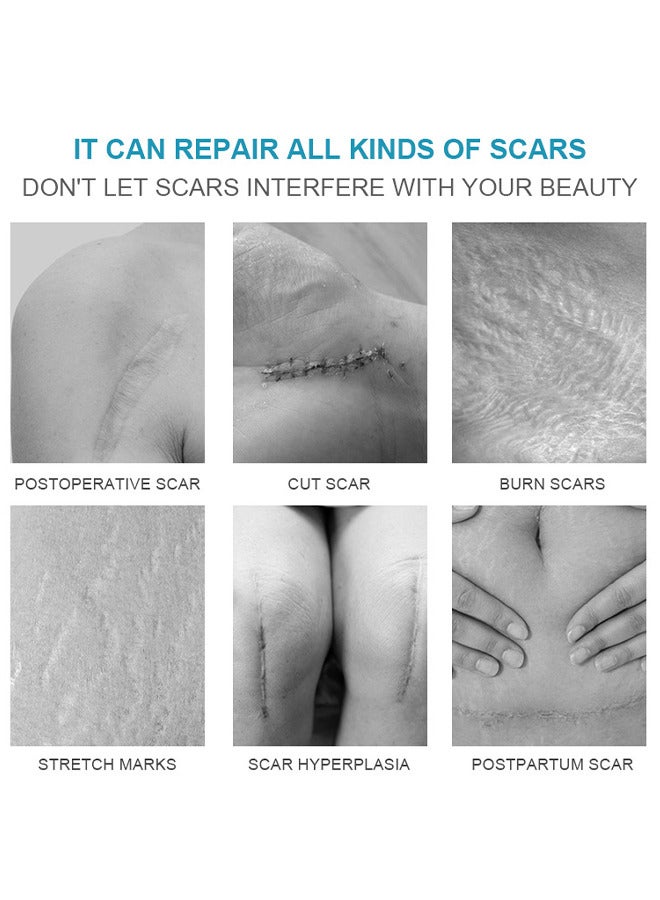 LANEMAY Scar Cream, Medical Grade Silicone Scar Cream Advanced Scar Removal Gel For Surgical Scars Stretch Marks Acne Injury Burns Keloids Hypertrophic Old And New Scars 20G - Image 5