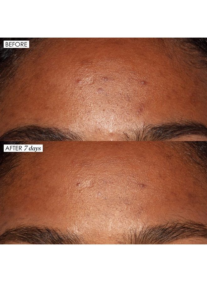 Sunday Riley Good Genes All-in-One Lactic Acid Treatment Face Serum - Image 2