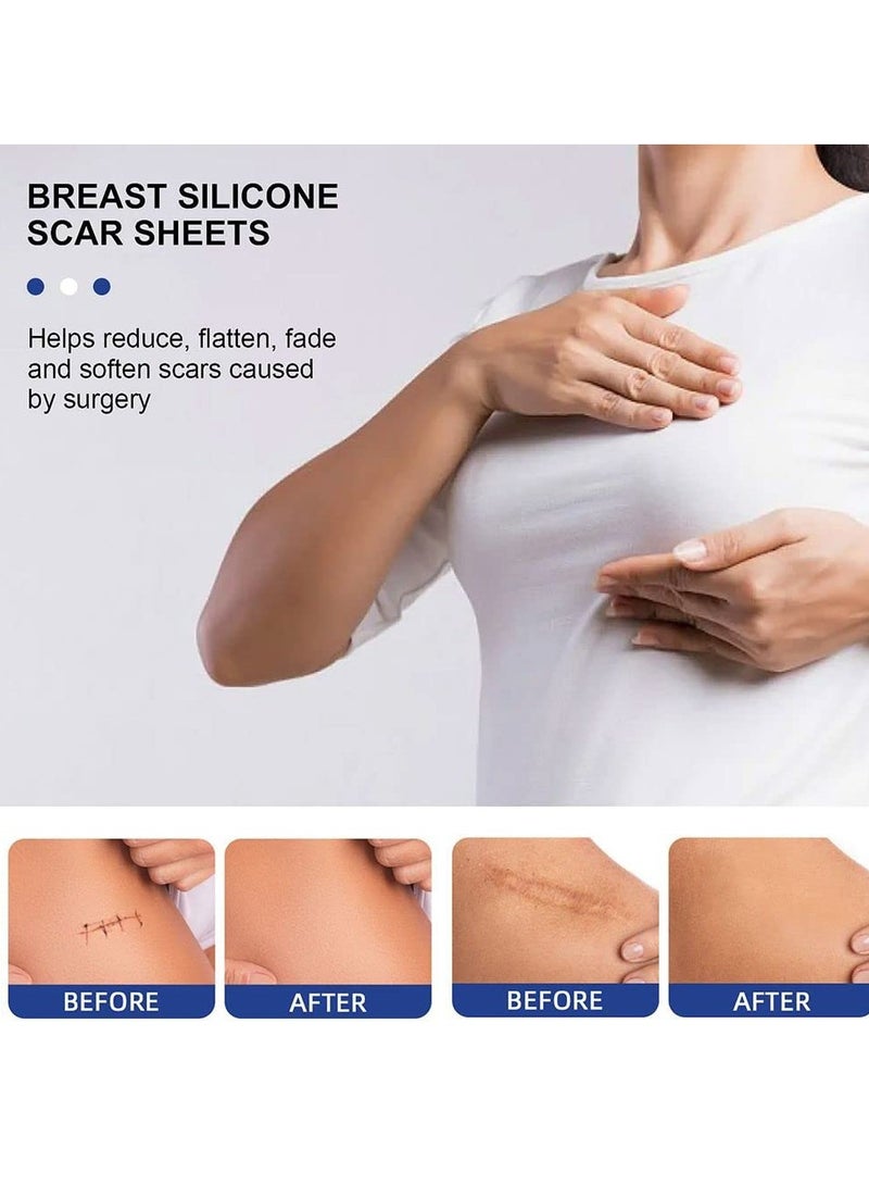 Silicone Scar Sheets, Reusable Washable Silicone Scar Tape, Surgery Scars Removal Treatment, Medical Grade Silicone Scar Sheets for Breast, 4 Areola Soft Strips  4 Anchor Sheets Care Patch - Image 5