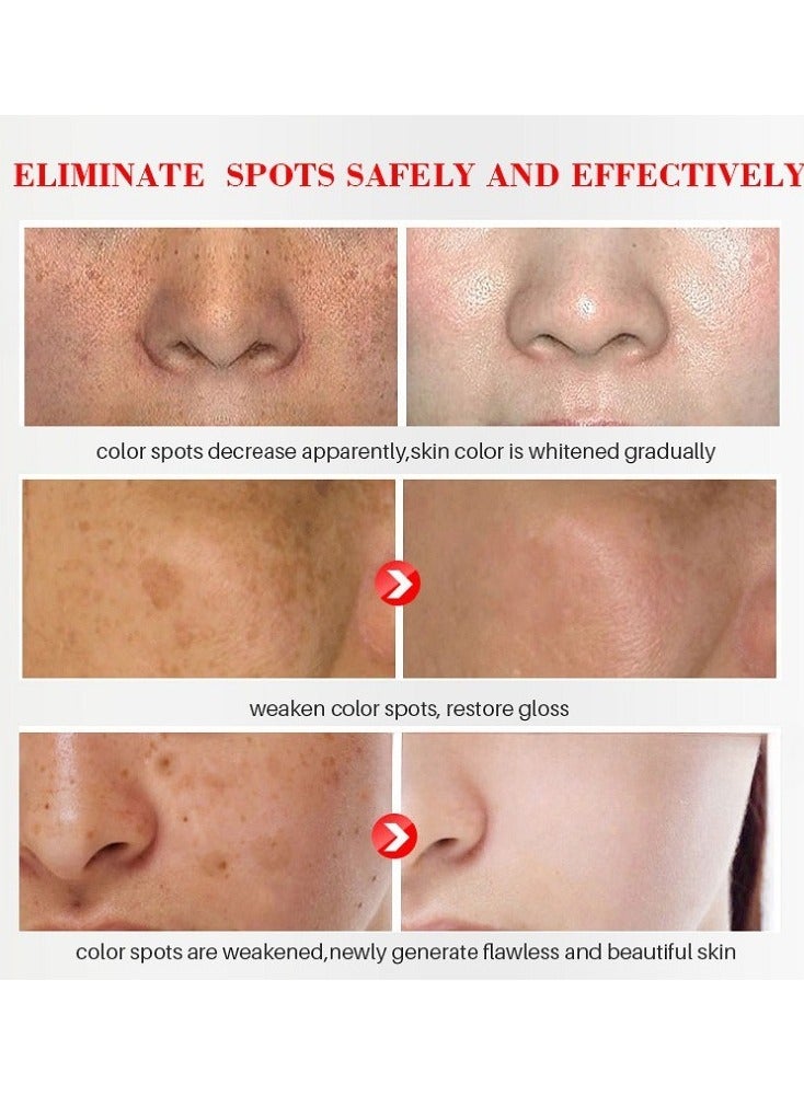 Kormesic Brightening Cream with Botanical Extracts – 20g Spot Care - Image 5