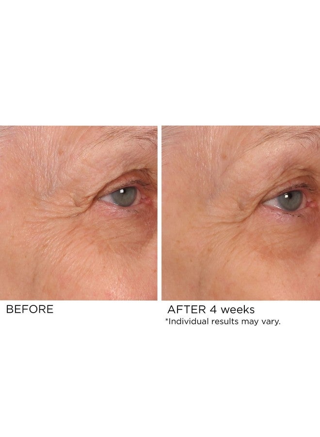 nassif md Nassifmd Eye Renewal Eye Wrinkle Cream, Anti Aging Eye Cream For Women, Firming Eye Cream, Under Eye Cream Dark Circles And Puffiness, Brightening Eye Cream - Image 2