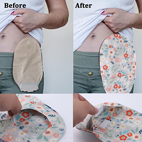 GLUKIEWT أغطية أكياس الأستومي GLUKIEWT - 3 قطع أغطية أكياس القولون، تقلل من الروائح، أغطية أكياس الأستومي بفتحة دائرية 3 بوصات للرجال أو النساء، إيليوستومي، قابلة للغسل - Image 2