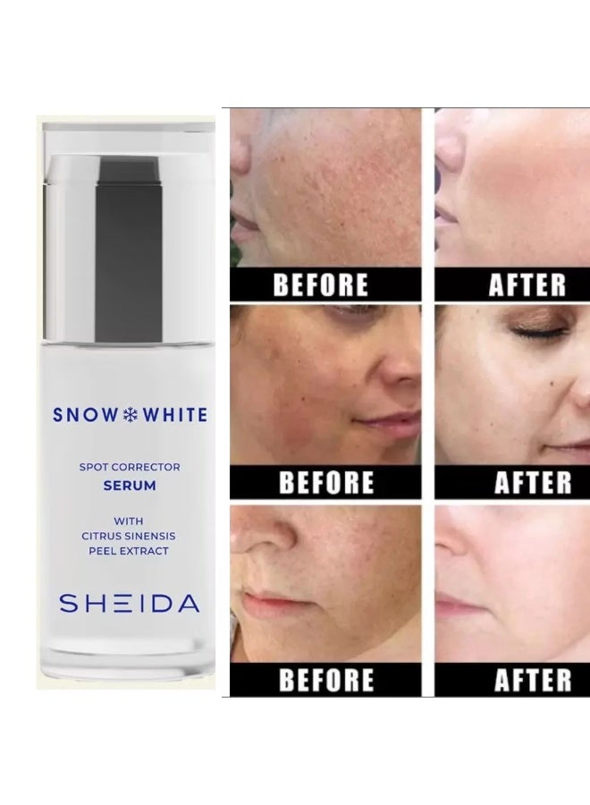 Sheida Snow White Spot Corrector Serum For All Skin 40 ML - Image 1