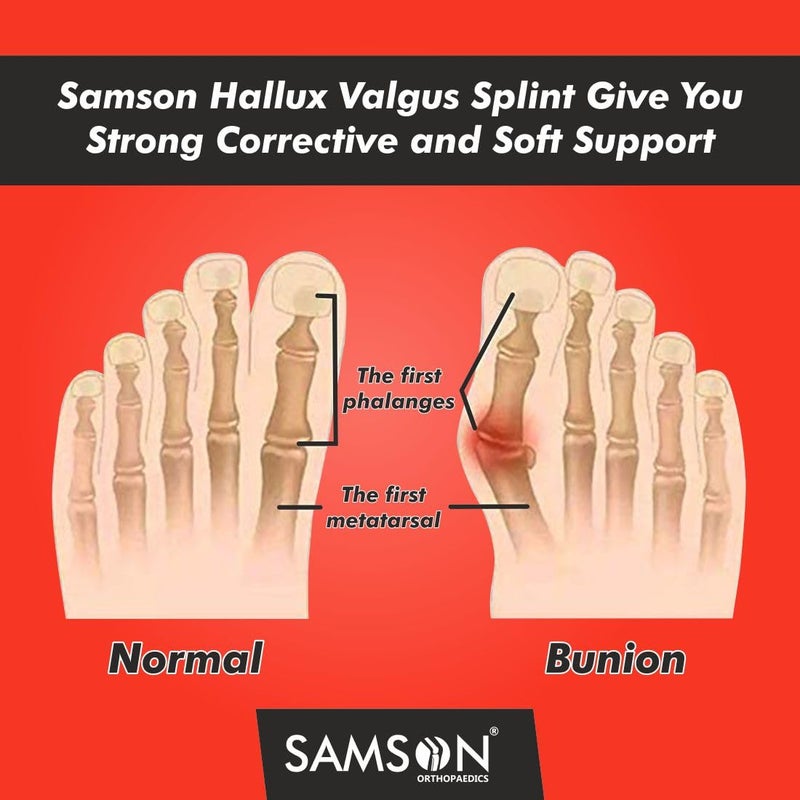 Samson دعامة هالوكس فالغوس، مصحح أصابع القدم مع دعم كسر الأصابع ودعم القدم لتخفيف الألم، فاصل أصابع، تقويم للأصابع، مصحح إبهام للنساء والرجال، عالمي - Image 3