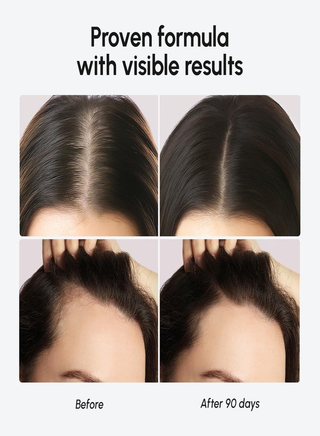 MAREE Hair Growth Serum - Caffeine Peptides Castor Rosemary Oil for Hair Growth - Products for Women & Men - Hair Oils for Hair Growth - Hair Regrowth Tonic - Scalp Serum - Suero Para El Cabello - Image 4