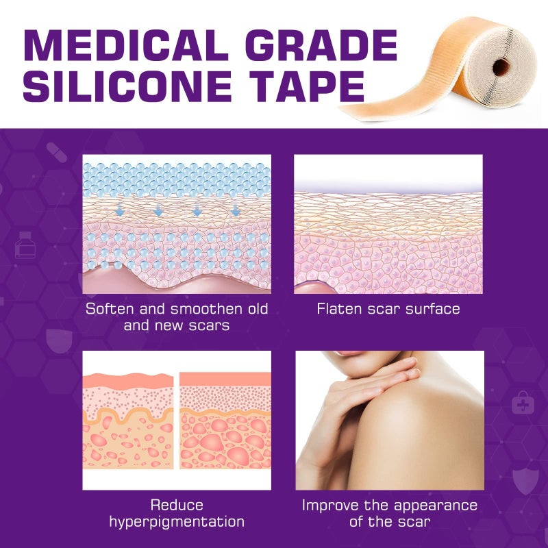 Kelinul Silicone Scar Sheets(1.6'' x 60''Roll-1.5M) - Soft Silicone Gel Scar Tape Painless Silicone Tape Roll - Reusable, Medical Grade Silicone Scar Removal Strips for C-Sectio - Image 2