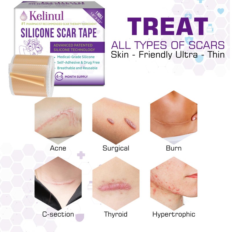 Kelinul Silicone Scar Sheets(1.6'' x 60''Roll-1.5M) - Soft Silicone Gel Scar Tape Painless Silicone Tape Roll - Reusable, Medical Grade Silicone Scar Removal Strips for C-Sectio - Image 3