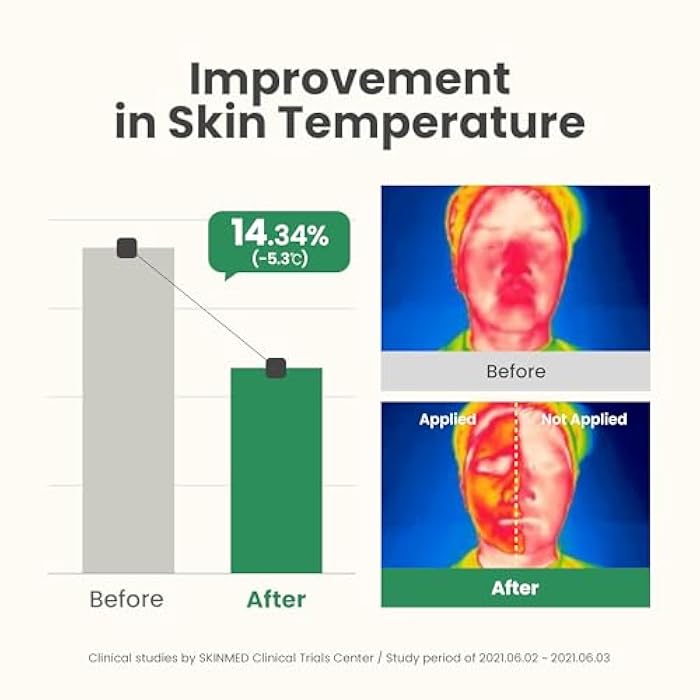 AXIS-Y New Skin Resolution Gel Mask Mugwort with 2% Niacinamide - Spot Treatment for Face, Barrier Repair & Brightening - Vegan Korean Skin Care Face Mask - 3.38 fl. oz. - Image 5