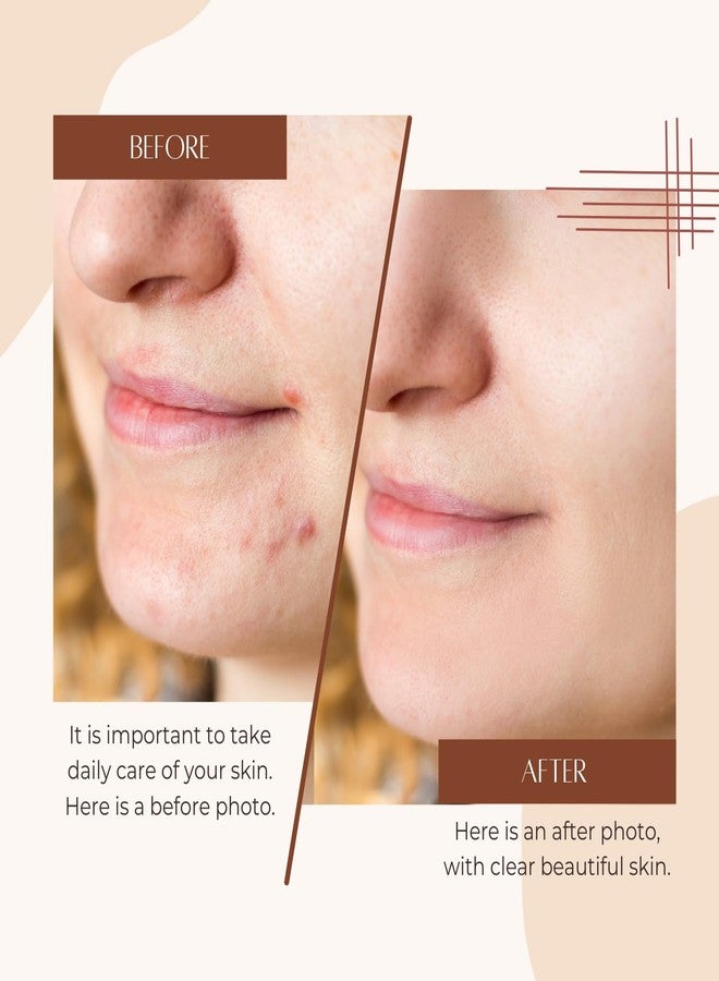 Emerge Professional Rice Water Cream - Korean Skincare Inspired Face Moisturizer for Dry, Dull Skin - Brightening & Smoothing Formula - Image 4