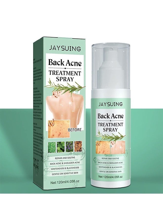 Jaysuing 120ml Back Acne Treatment, Back Acne Spray, 2% Salicylic Acid Spray, Body Acne Treatment with Herbal Formula, Body Acne Spray, Tea Tree Oil Spray, Acne Treatment For Teens, Back Acne  - Image 1