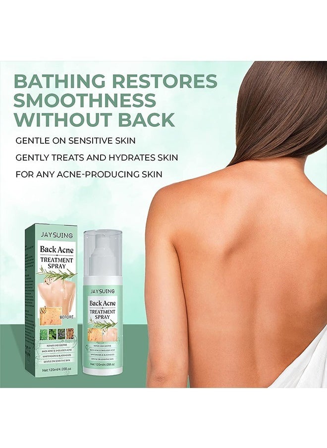 Jaysuing 120ml Back Acne Treatment, Back Acne Spray, 2% Salicylic Acid Spray, Body Acne Treatment with Herbal Formula, Body Acne Spray, Tea Tree Oil Spray, Acne Treatment For Teens, Back Acne  - Image 5