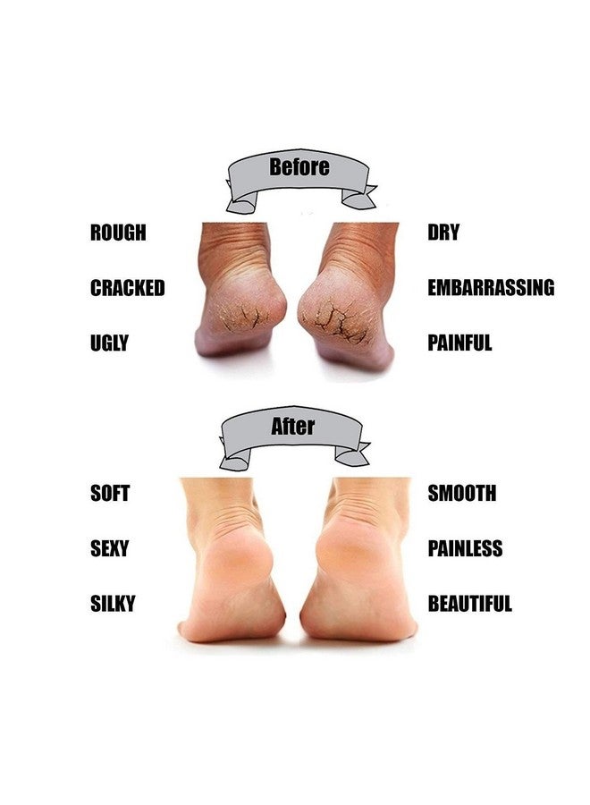 JHEPCOIN Cotton Foot Protector Moisturizing Socks with Spa Gel,Heel Pain Relief Silicone Gel Pad Heel Protector Socks with Spa Botanical for Men and Women Cotton Socks - Image 3