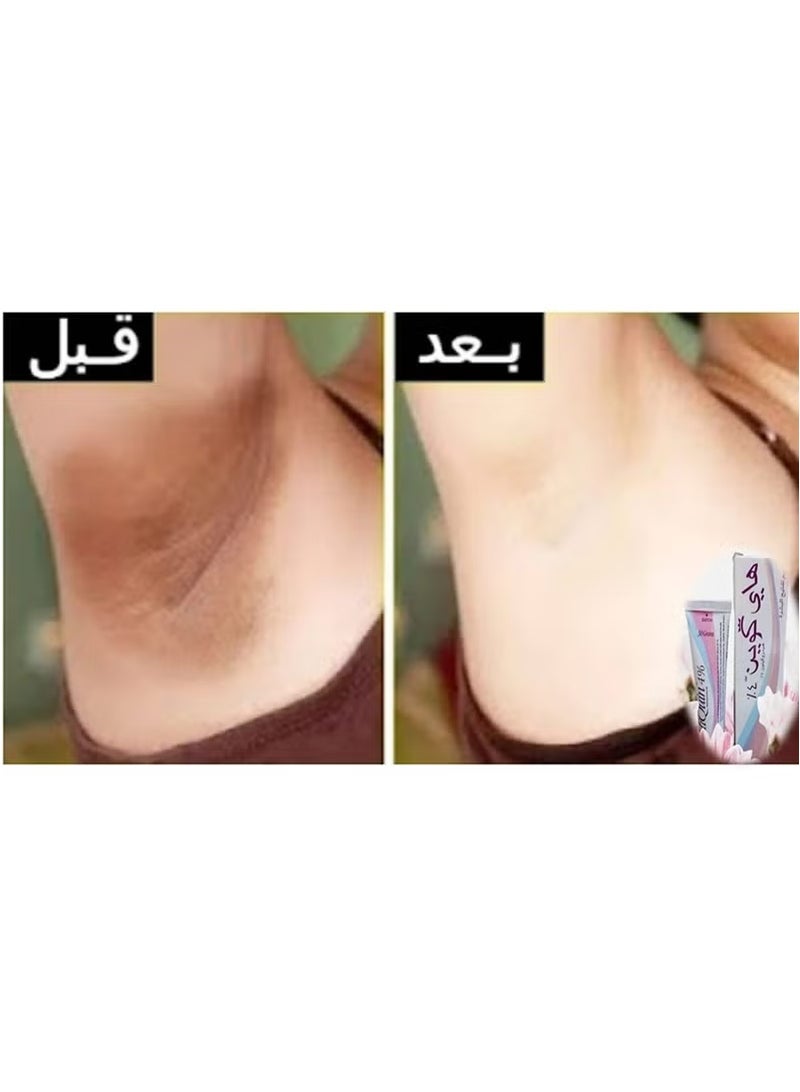 هاي كوين باقة من عبوتين كريم تفتيح البشرة 2% من هاي كوين  3x - Image 5