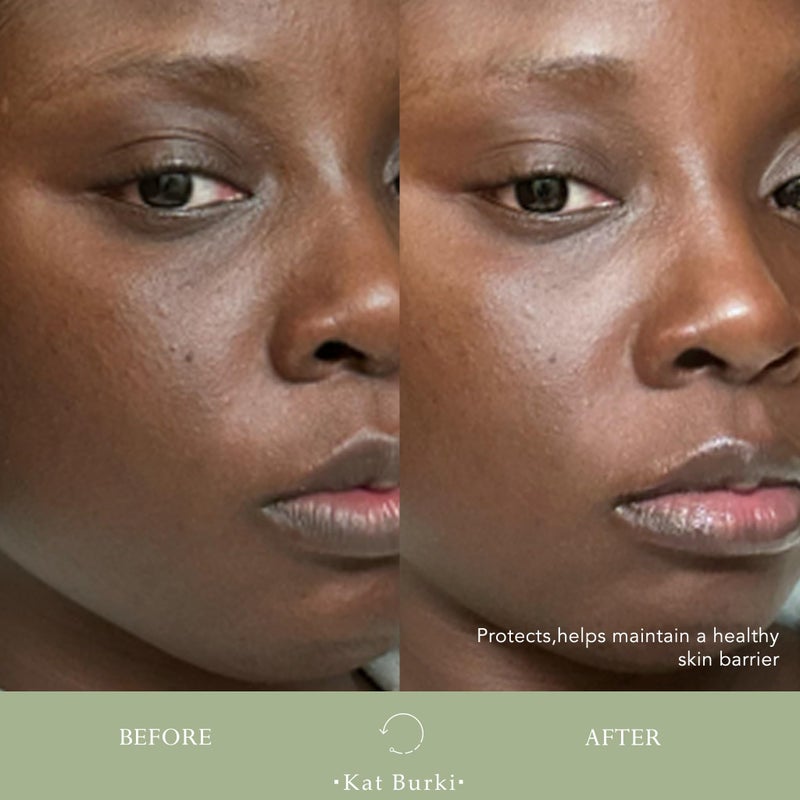 KAT BURKI KB5 Calming Gel Cleanser, Gentle Moisturizing Face Wash & Makeup Remover With Hydrating Botanicals for Sensitive Skin, 4.4 Fl Oz - Image 4