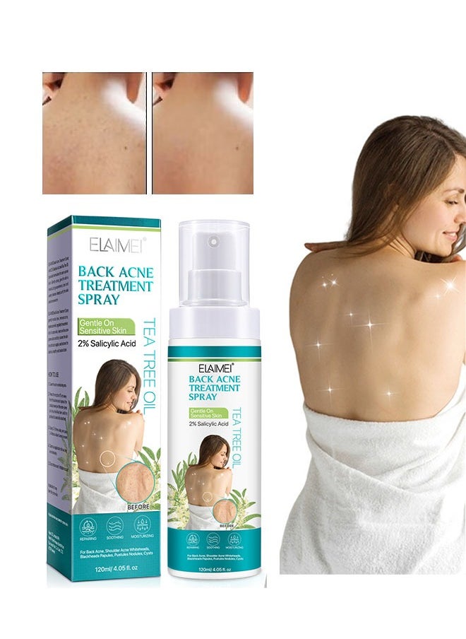 Elaimei Back Acne Treatment Spray, Anti Back Acne with 2% Salicylic Acid, Acne Treatment for Back and Body Acne,Soothing and Moisturizing Spray 120ml  - Image 1