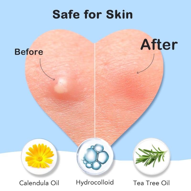 TKTK Pimple Patches for Face: 6 Sizes Day and Night Acne Patches Heart Zit Patches - Cute Spot Stickers with Tea Tree & Centella Oil, Strong Adhesion Zit Covers (196 Count) - Image 4
