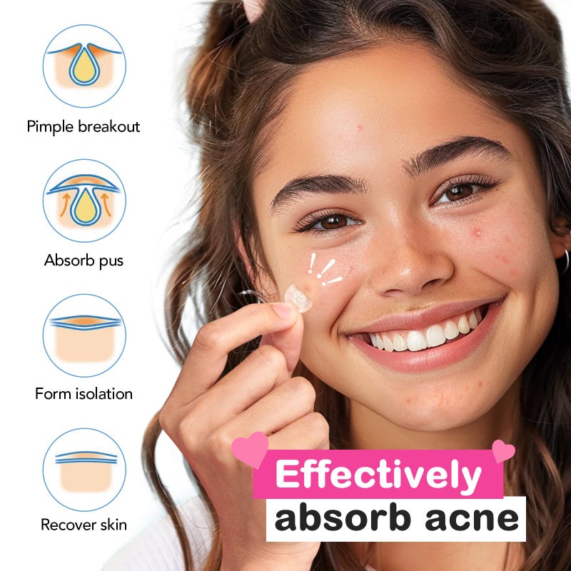 TKTK Pimple Patches for Face: 6 Sizes Day and Night Acne Patches Heart Zit Patches - Cute Spot Stickers with Tea Tree & Centella Oil, Strong Adhesion Zit Covers (196 Count) - Image 5