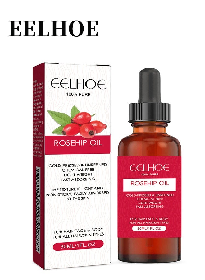إيلهو زيت ثمر الورد - معصور على البارد وغير مكرر 100٪ - غير دهني عالي الامتصاص - يغذي ويرطب ويقلل بشكل كبير من الخطوط الدقيقة والندبات وعلامات التمدد والجلد والشعر والجسم والوجه لثمر الورد - Image 1