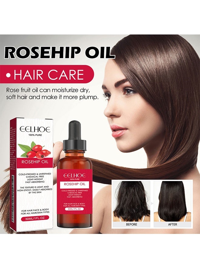 إيلهو زيت ثمر الورد - معصور على البارد وغير مكرر 100٪ - غير دهني عالي الامتصاص - يغذي ويرطب ويقلل بشكل كبير من الخطوط الدقيقة والندبات وعلامات التمدد والجلد والشعر والجسم والوجه لثمر الورد - Image 2