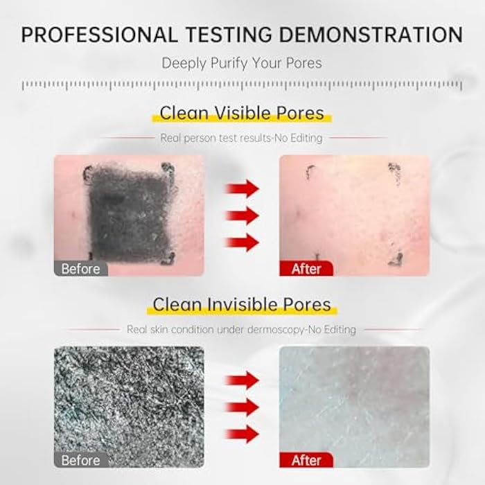 VGO Facial Cleanser, Daily Face Wash for Deep Pore Cleanser and Makeup Remover for Sensitive Oily Skin, Double Tube Design with Hyaluronic Acid, 3.52 Oz - Image 4