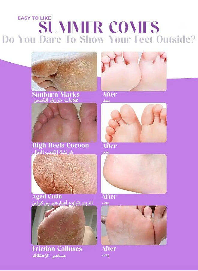 SADOER - Foot Peel Mask 3 PCS-Foot Spa Foot Care For Women Peel Mask With Lavender For Men And Women Feet Peeling Mask Exfoliating, Repair Rough Heels, Foot Mask For Baby Soft Skin - Remove Dead Skin-Lavender - Image 1