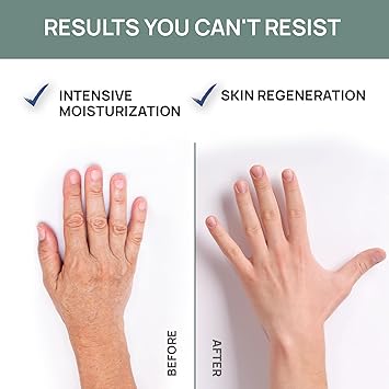 Vis Plantis كريم اليدين المكثف من فيس بلانتس لليدين الجافة جداً مع اليوريا وزيت الزيتون وترشيح إفراز الحلزون 135 مل كريم مرطب لليدين للبنات والأولاد طبيعي نباتي قناع أظافر مع مضخة - Image 2