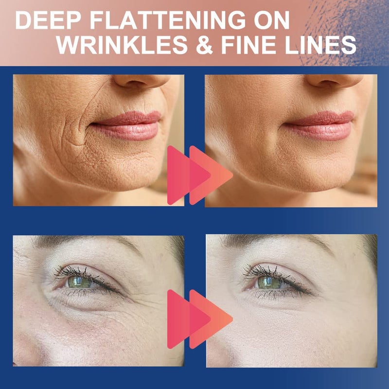 Akissos 2 Rolls Anti wrinkle Patches Face Patches Neck Patches Unisex For Firming and Tightening Skin 2.5cm*5m - Image 5