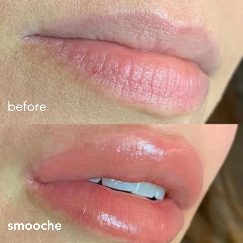 Smooche - Long Lasting Lip Plumper - Image 3
