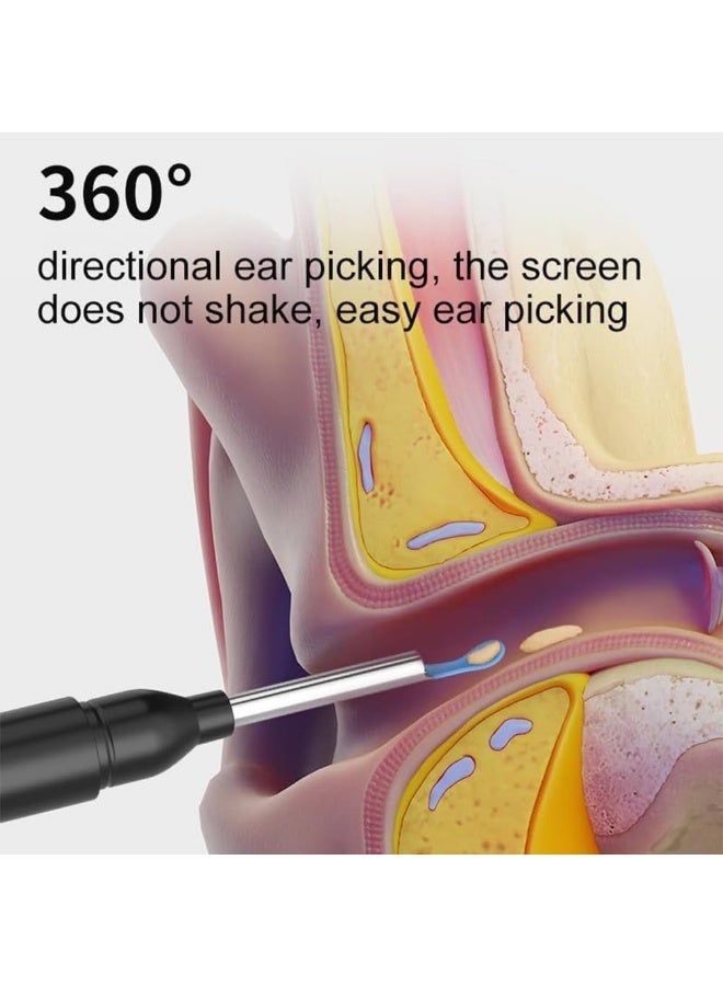 YelaJoy Ear Wax Removal, 2000w HD camera,  Wi-Fi Visible Wax Elimination Spoon, Earwax Remover Tool with 8 Pcs Ear Set and 6 soft silicone ear spoons, Earwax Removal Kit with Light , Ear Cleaner for iOS & Android (Black 7-Piece Set) - Image 3