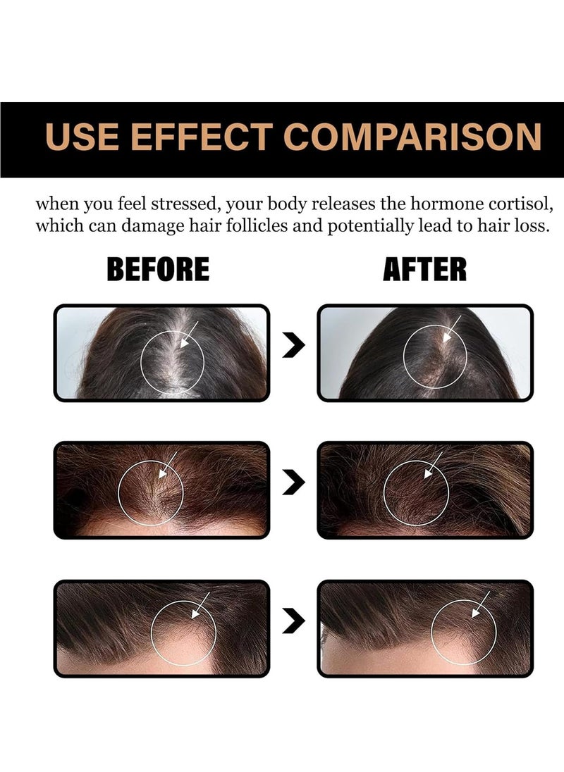 LUNOON - Anti-Thinning Shampoo, Root Activator, Hair Regrowth, Hair Thickening, Deep Moisturizing, Natural Formula Shampoo for Dry Damaged Weak and Thin Hair Care 100ml - Image 1