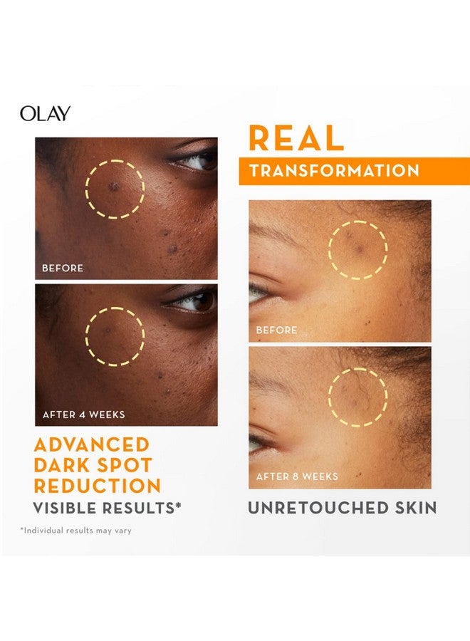 Olay Vitamin C Kit For 2X Glow | Vitamin C Cream With Free Cleanser L Even Glow And Smooth Texturee | With Niacinamide L Normal, Oily, Dry & Combination Skin L Parabens & Sulphate Free | Pack Of 2 - Image 4