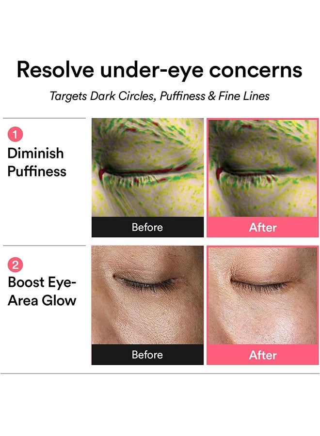 ابيب Pdrn شبكية العين التصحيح جلو جيلي 60 بقع / 30 أزواج ، تحت بقع العين للعيون المنتفخة والدوائر المظلمة ، مكافحة التجاعيد مع الكولاجين ، الكافيين ، نياسيناميد - Image 4