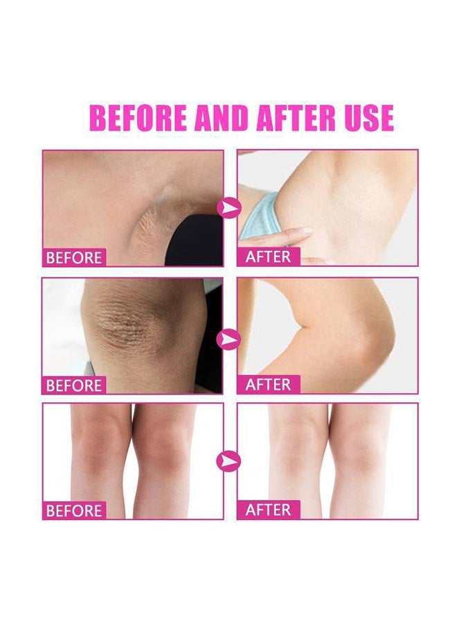 Whitening Cream, For Body, Intimate Areas, Underarms, Armpit, Knees, Legs, Elbows And Inner Thigh, Dark Spot Corrector Skin Lightening Cream 100ml