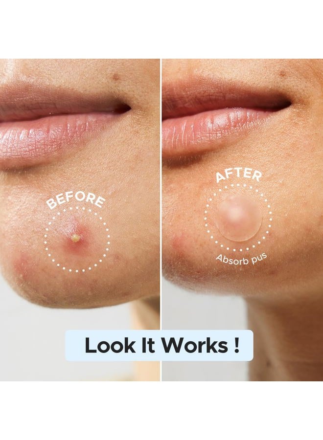 LitBear Pimple Patch Bulk, 480 Patches 3 Size Acne Patches for Face, Hydrocolloid Spot Stickers for Covering Zits, Blemishes, and Breakouts, Suitable for All Skin Types - Image 4