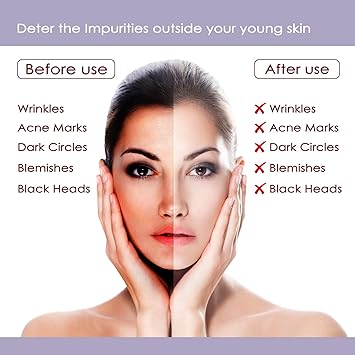 NUTRIGLOW مجموعة العناية بالبشرة من نوتري جلو بلاتينوم دايموند جولد واللؤلؤ 6 قطع 250 جرام 10 مل - Image 5