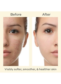 The Natural And Organic Family Face Cream For Teen Girls Boys Organic Face Moisturizer For Dry Skin Soothing Facial Cream With Tea Tree Moisturizer Daily Face Moisturizer For Acne Prone Skin Hyaluronic Acid Moisturizer  - Image 5