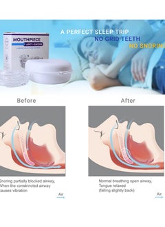 Joshberg Anti Snoring Bruxism Mouth Guard Improve Sleeping Apnea Snoring Device To Stop Snoring  - Image 4