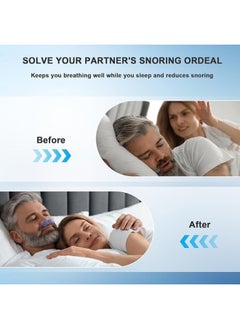 Generic Double Vortex Anti-Snoring Device, Portable Snoring Solution, Adjustable and Ventilated, Effective Sleep Aid for Men and Women, Multicolor  - Image 4