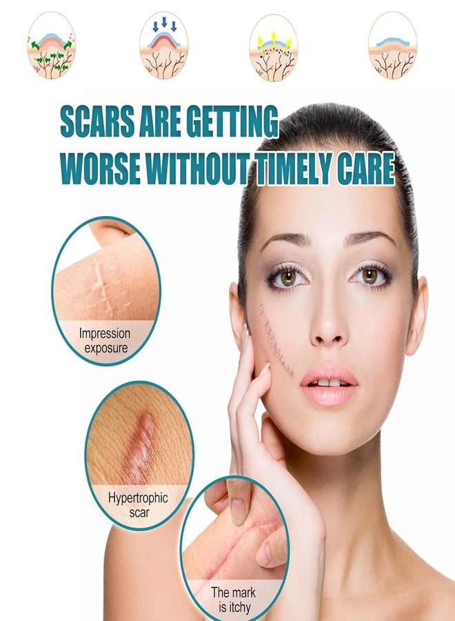 VANITYA شرائح جل السيليكون من فانيتيا للندبات | شرائط طبية لإزالة الندبات الجراحية، والندبات الجدرية، وندبات الولادة القيصرية، والحروق، وندبات حب الشباب، قابلة لإعادة الاستخدام والغسل | شرائح جل ناعمة وغير مرئية وغير مؤلمة للندبات - Image 3