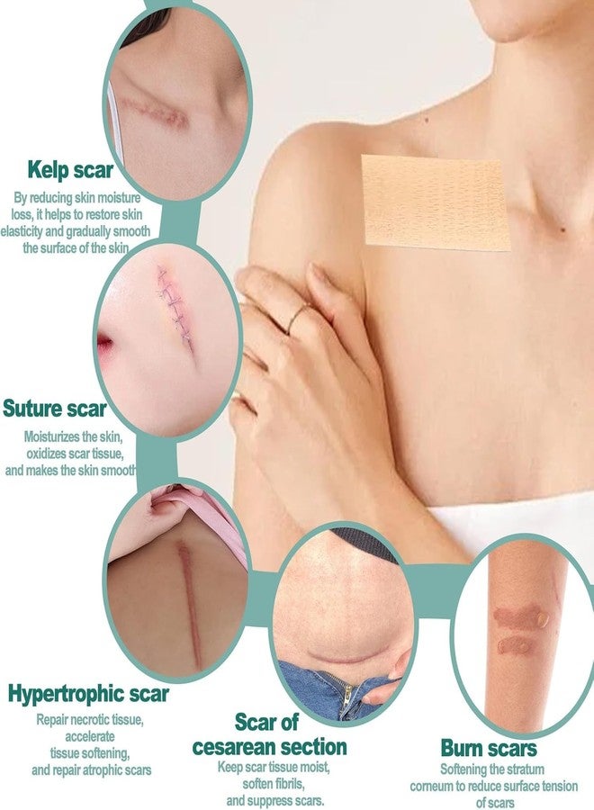 VANITYA شرائح جل السيليكون من فانيتيا للندبات | شرائط طبية لإزالة الندبات الجراحية، والندبات الجدرية، وندبات الولادة القيصرية، والحروق، وندبات حب الشباب، قابلة لإعادة الاستخدام والغسل | شرائح جل ناعمة وغير مرئية وغير مؤلمة للندبات - Image 4