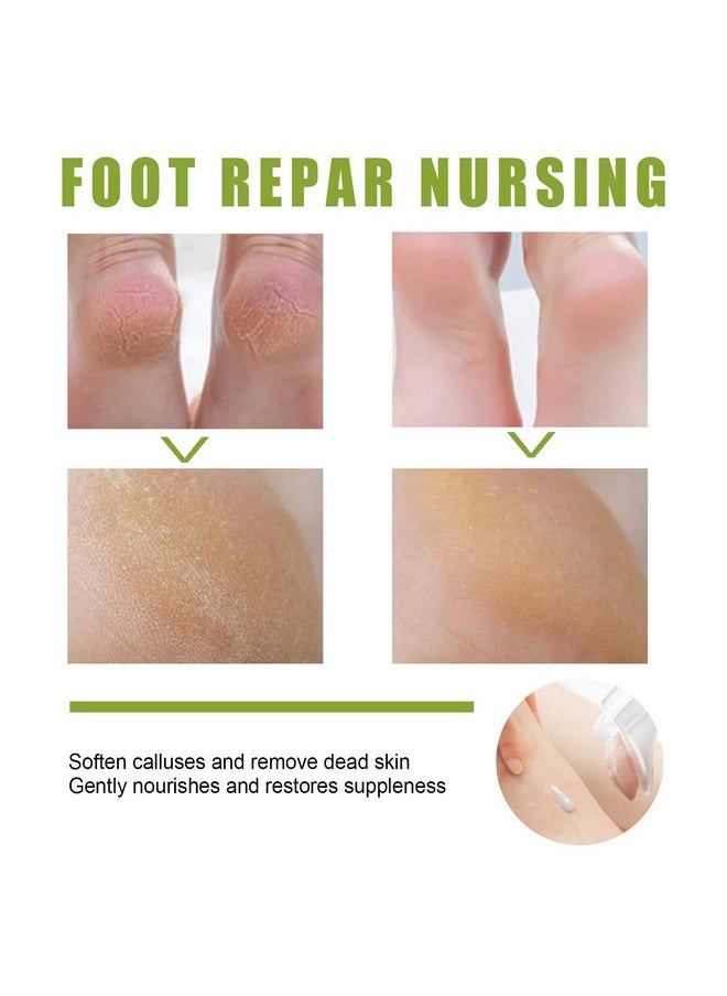 2Pcs Foot Peeling Spray Orange Oilfoot Peeling Spray That Remove Dead Skin Within Secondshydrating Nourish Peel Off Spray Exfoliating Peeling & Calluses On Feet (30Ml) - pzsku/Z12EBB3F459D06ED0F0D2Z/45/_/1721025038/97ba27a5-9be2-483d-b53e-25ef1e4a45cd