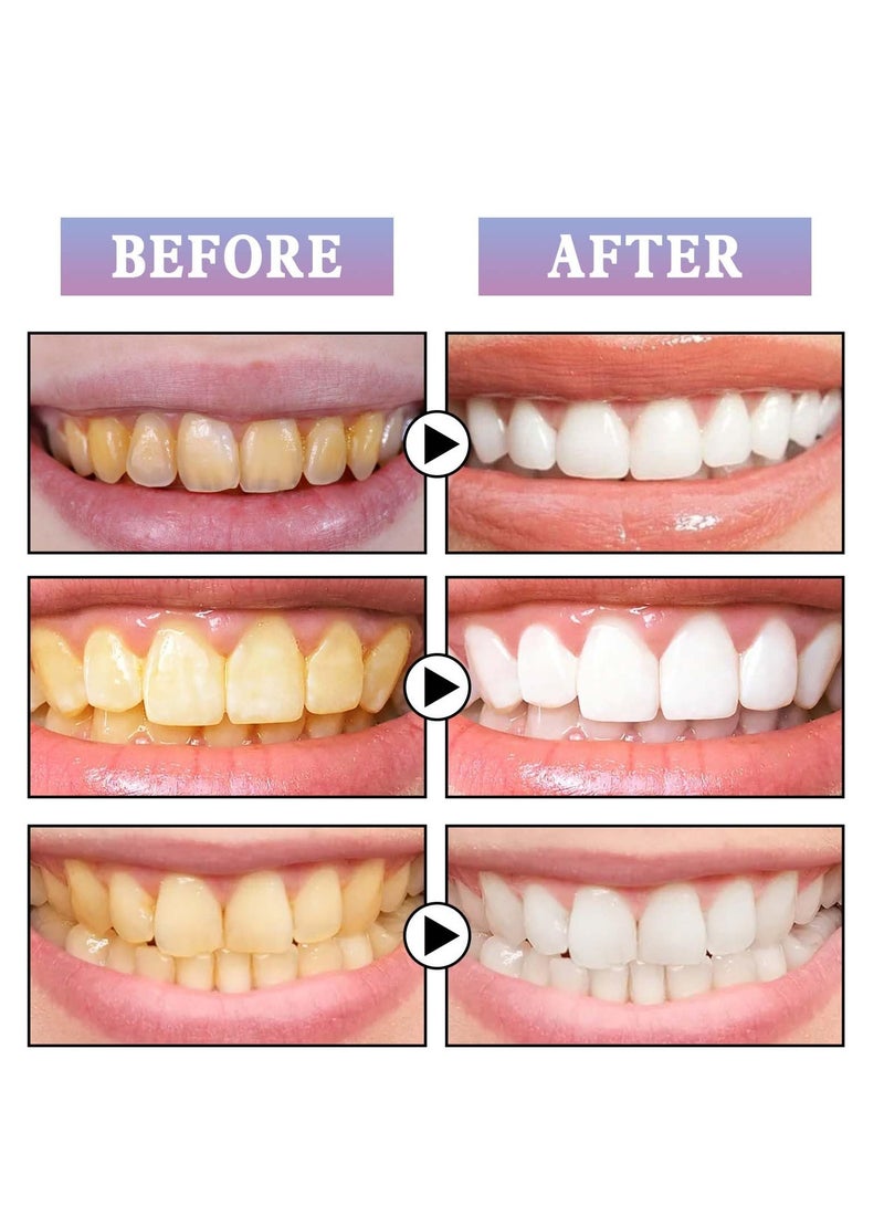 Excefore Tooth Gloss, 2 Pcs Purple Teeth Whitening, Tooth Stain Removal, for Tooth Stain Removal, Instant Gloss Results, Fast Removes Years of Stains - Image 5