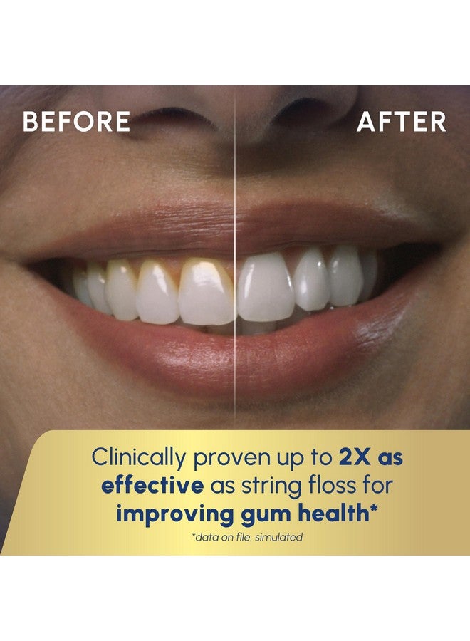 Waterpik Cordless Advanced 2.0 Water Flosser For Teeth, Gums, Braces, Dental Care With Travel Bag and 4 Tips, ADA Accepted, Rechargeable, Portable, and Waterproof, White WP-580, Packaging May Vary - Image 5