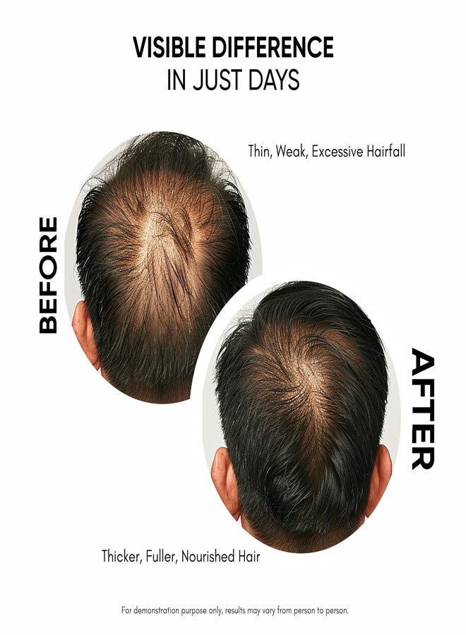 Masofta Hair Growth Serum For Promoting Hair Growth & Controlling Hair Fall With 3% Redensyl, 5% Capixyl, 4% Anagain, 3% Procapil & 3% Baicapil, Rosemary & Biotin, For Both Men & Women, 50ML - Image 3