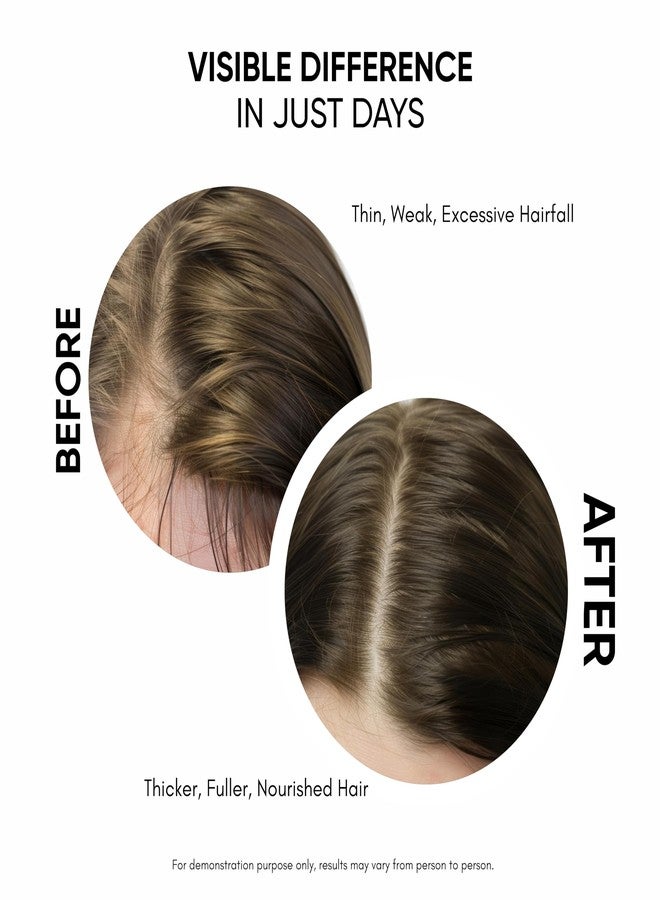Masofta Hair Growth Serum For Promoting Hair Growth & Controlling Hair Fall With 3% Redensyl, 5% Capixyl, 4% Anagain, 3% Procapil & 3% Baicapil, Rosemary & Biotin, For Both Men & Women, 50ML - Image 4