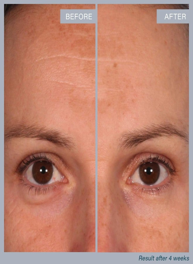 Skinn وسادات تقشير متعددة الأحماض من SKINN، مع حمض الجليكوليك، وحمض اللاكتيك، وحمض الساليسيليك، 60 وسادة - تقشير كيميائي من هازيل الساحرة للوجه، والرقبة، والصدر، يقشر، ويضيء، ويشد البشرة، لخطوط دقيقة وتجاعيد - Image 3