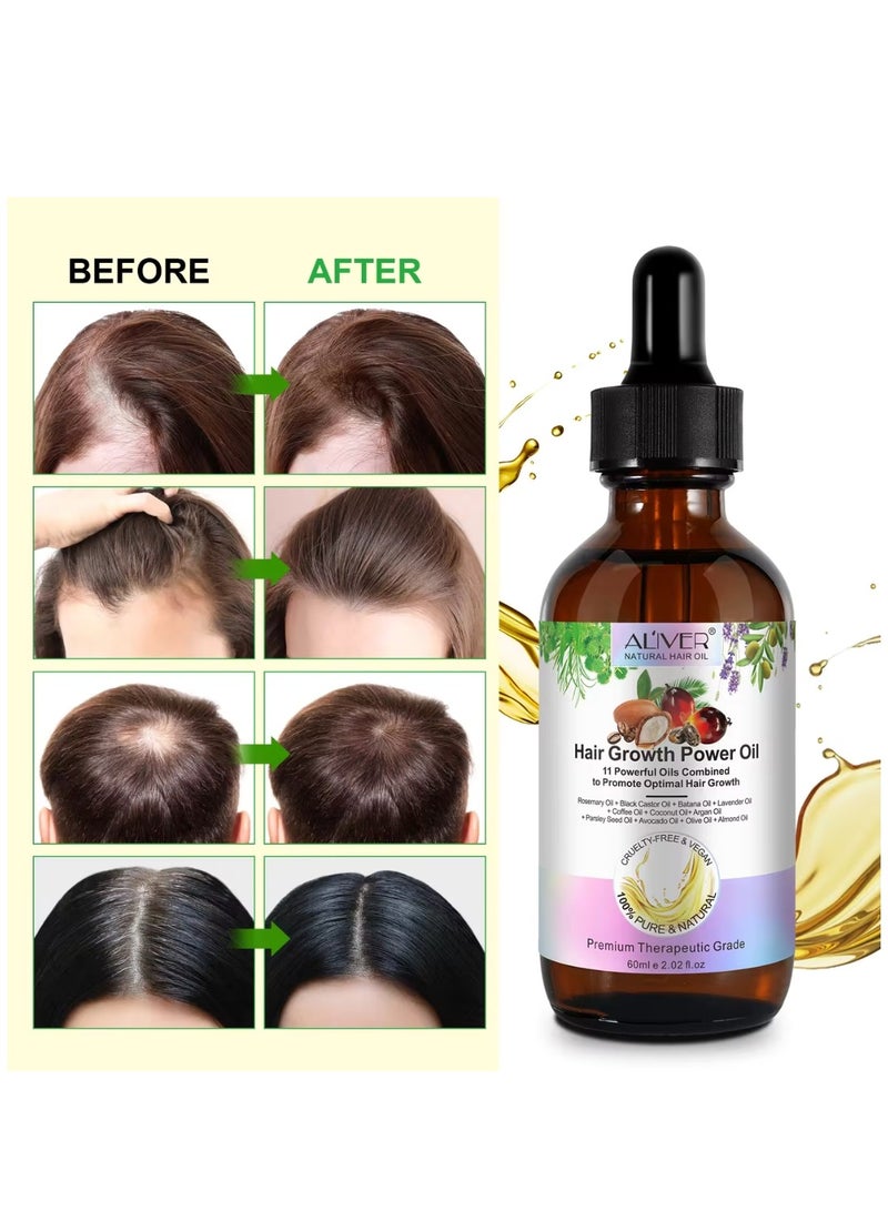 ALIVER 60ml Hair Growth Power Oil 11 in 1 Hair Growth Oil with Rosemary & Batana Oil for Thin Hair Repair Damaged Hair Nourishes Thin Hair Scalp Skin and Loss Hair Growth Fit for All Hair Types - Image 2