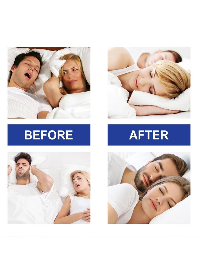 CMGTYYD CMGTYYD Sleep Tape Strips, 30 Pcs Mouth Tape for Sleeping, Anti Snoring Mouth Strips, Anti Snoring Aid for Men & Women, Reusable Hypoallergenic Premium Quality Snoring Strips Pain-Free Removal  - Image 3